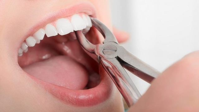 Chiêm bao răng rụng đánh số nào?