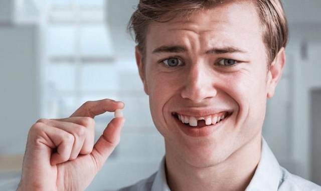 Giới thiệu chung về giấc mơ rụng răng