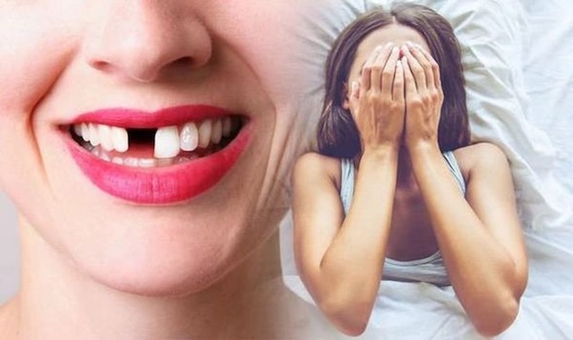 Ý nghĩa khoa học và ý nghĩa tâm linh của giấc mơ răng rụng