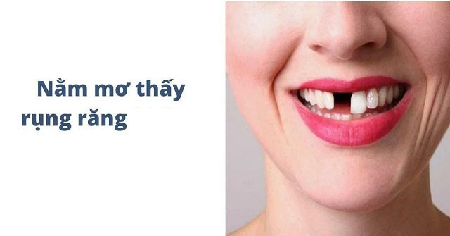 Khám phá điềm báo tương lai khi mơ rụng răng Khám phá điềm báo tương lai khi mơ rụng răng