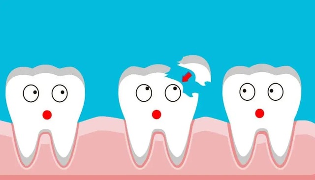 Mơ bị mẻ răng là điềm lành hay dữ? Khám phá gợi ý số mơ